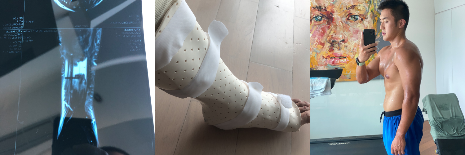 Tech Grip Socks were inspired by my Achilles Injury